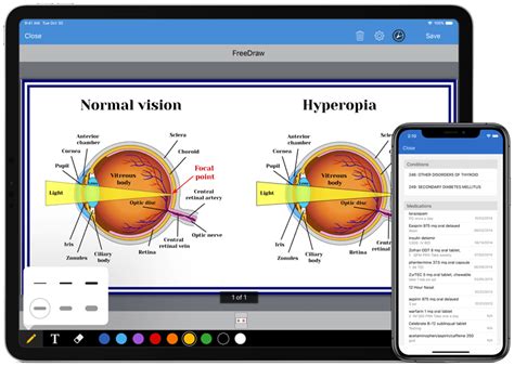best ehr for optometry
